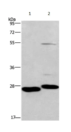 Western blot - Anti-FSP27 antibody (AB198204)