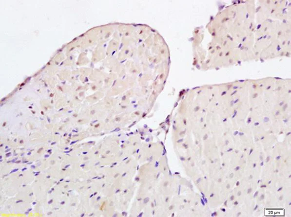 Immunohistochemistry (Formalin/PFA-fixed paraffin-embedded sections) - Anti-FSP27 antibody (AB213693)