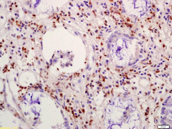 Immunohistochemistry (Formalin/PFA-fixed paraffin-embedded sections) - Anti-FSP27 antibody (AB213693)