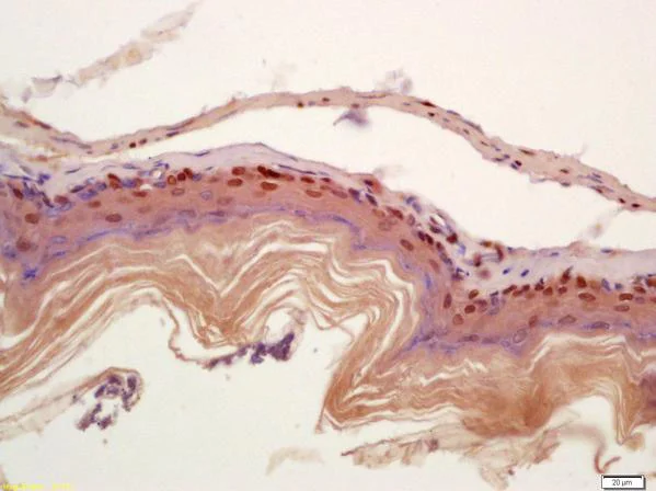 Immunohistochemistry (Formalin/PFA-fixed paraffin-embedded sections) - Anti-FSP27 antibody (AB213693)
