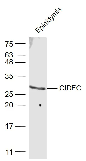 Western blot - Anti-FSP27 antibody (AB213693)