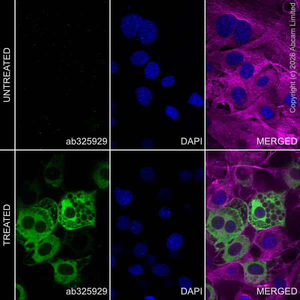 Immunocytochemistry/ Immunofluorescence - Anti-FSP27/CIDEC antibody [EPR29812-32] (AB325929)