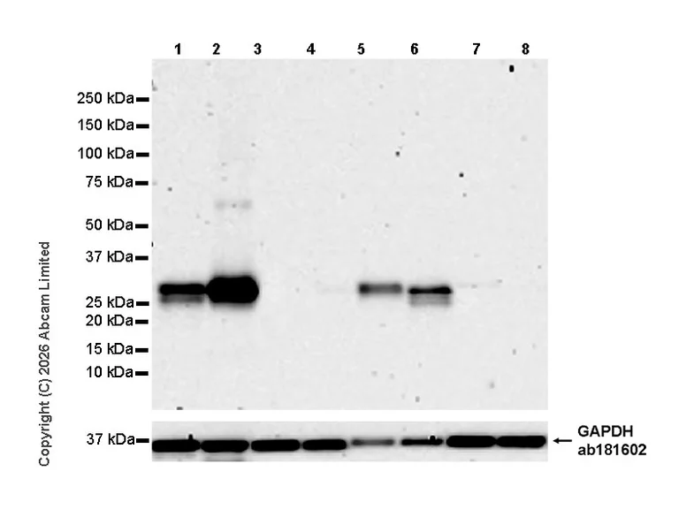 Western blot - Anti-FSP27/CIDEC antibody [EPR29812-32] (AB325929)
