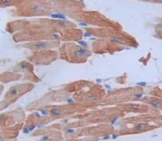 Immunohistochemistry (Formalin/PFA-fixed paraffin-embedded sections) - Anti-FSTL3 antibody (AB232761)