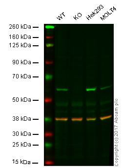 Western blot - Anti-FTO antibody [5-2H10] (AB92821), expandable thumbnail