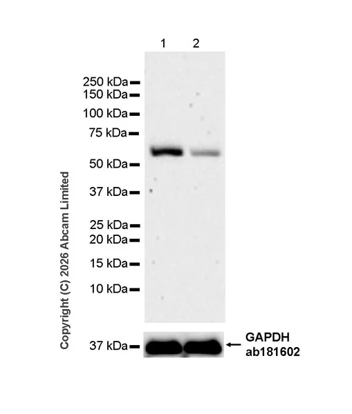 Western blot - Anti-FTO antibody [EPR31059-535] (AB327339)