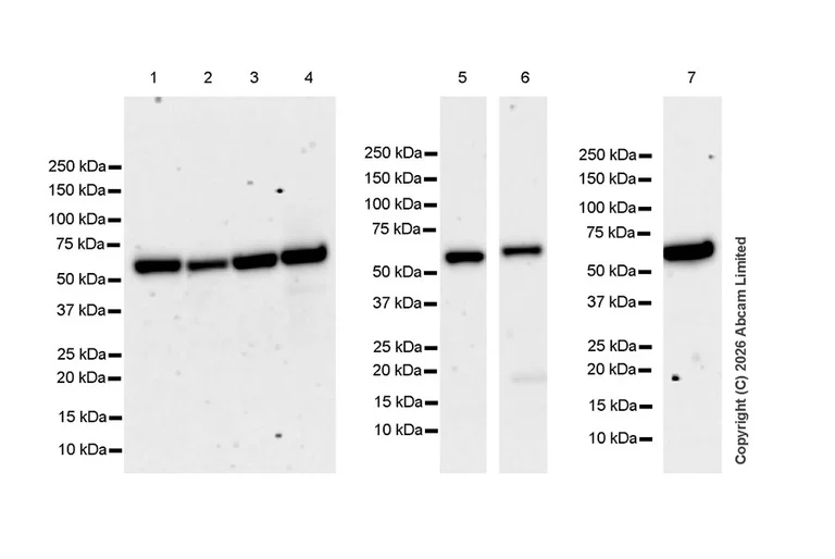 Western blot - Anti-FTO antibody [EPR31059-535] (AB327339)