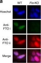 Immunocytochemistry/ Immunofluorescence - Anti-FTO antibody [EPR6894] (AB126605)