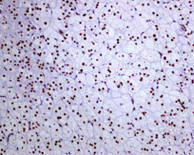 Immunohistochemistry (Formalin/PFA-fixed paraffin-embedded sections) - Anti-FTO antibody [EPR6894] (AB126605), expandable thumbnail
