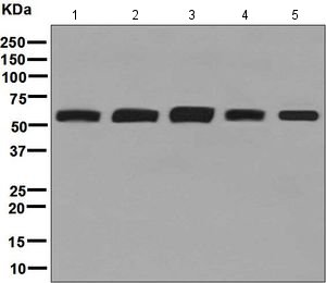 Western blot - Anti-FTO antibody [EPR6894] (ab126605), expandable thumbnail