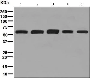Western blot - Anti-FTO antibody [EPR6894] (AB126605)