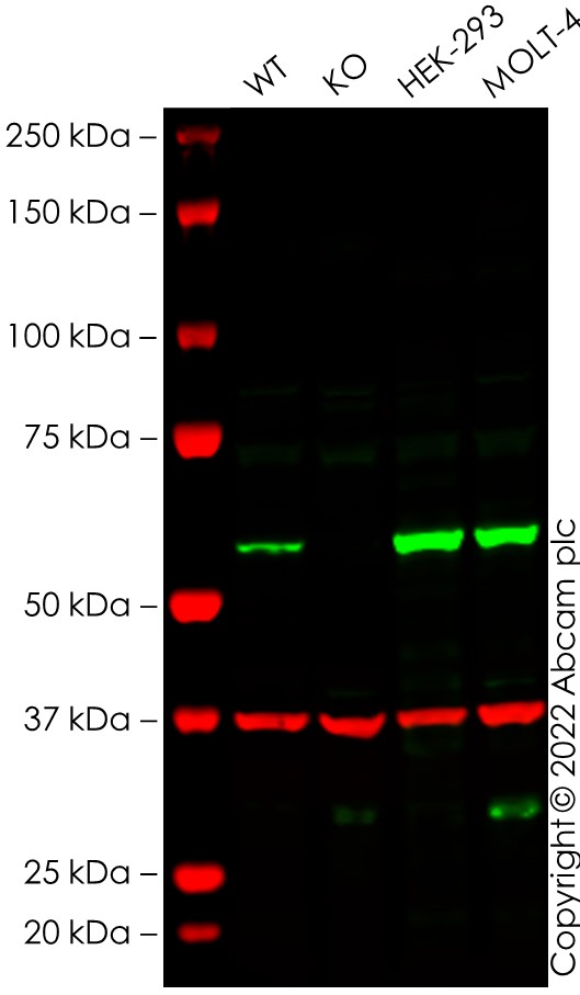 Western blot - Anti-FTO antibody [EPR6894] (ab126605), expandable thumbnail