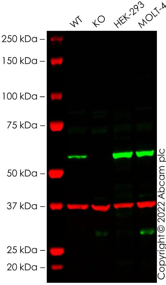 Western blot - Anti-FTO antibody [EPR6894] (AB126605)