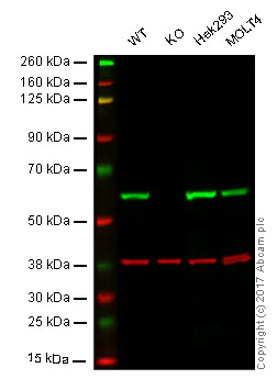 Western blot - Anti-FTO antibody [EPR6894] (AB126605)