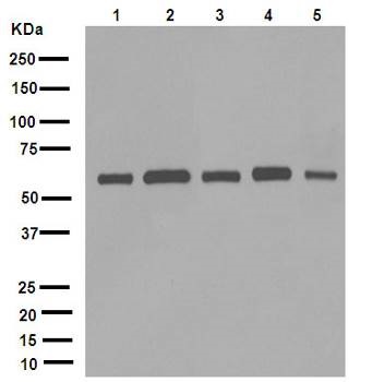 Western blot - Anti-FTO antibody [EPR6894] (AB126605), expandable thumbnail