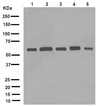 Western blot - Anti-FTO antibody [EPR6894] (AB126605)
