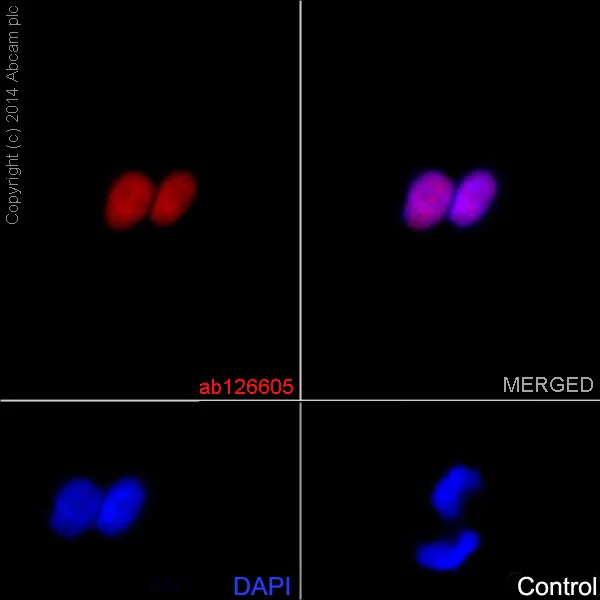 Immunocytochemistry/ Immunofluorescence - Anti-FTO antibody [EPR6894] - BSA and Azide free (AB240021)