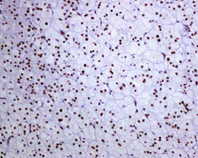 Immunohistochemistry (Formalin/PFA-fixed paraffin-embedded sections) - Anti-FTO antibody [EPR6894] - BSA and Azide free (AB240021)