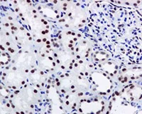 Immunohistochemistry (Formalin/PFA-fixed paraffin-embedded sections) - Anti-FTO antibody [EPR6895] (AB124892)