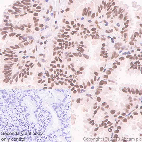 Immunohistochemistry (Formalin/PFA-fixed paraffin-embedded sections) - Anti-FTO antibody [EPR6895] (AB124892)