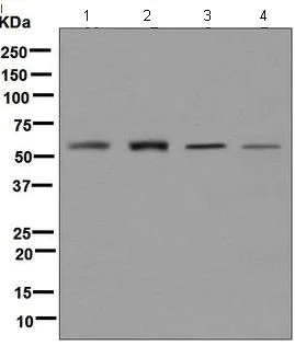 Western blot - Anti-FTO antibody [EPR6895] (AB124892)