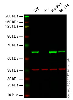 Western blot - Anti-FTO antibody [EPR6895] - BSA and Azide free (AB242390), expandable thumbnail