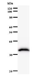 Western blot - Anti-FTSJ2 antibody [2372C6a] (AB60068), expandable thumbnail