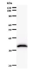 Western blot - Anti-FTSJ2 antibody [2372C6a] (AB60068)