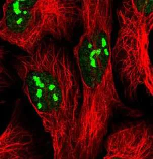 Immunocytochemistry/ Immunofluorescence - Anti-FTSJ3 antibody (AB185678)