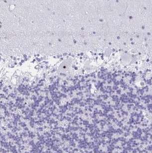 Immunohistochemistry (Formalin/PFA-fixed paraffin-embedded sections) - Anti-FTSJ3 antibody (AB185678)