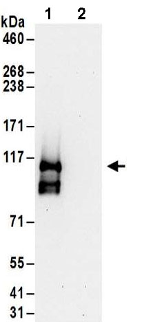 Immunoprecipitation - Anti-FTSJ3 antibody (AB185996)