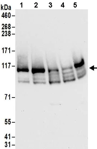 Western blot - Anti-FTSJ3 antibody (AB185996)
