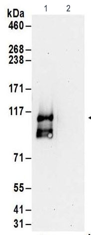 Immunoprecipitation - Anti-FTSJ3 antibody - N-terminal (AB186009)
