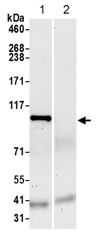 Immunoprecipitation - Anti-FTSJD2 antibody (AB70386)