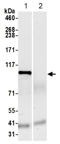 Immunoprecipitation - Anti-FTSJD2 antibody (AB70386)