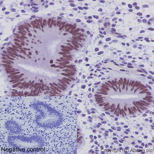Immunohistochemistry (Formalin/PFA-fixed paraffin-embedded sections) - Anti-FUBP1/FBP antibody [EPR12326] (AB192867)