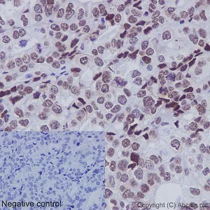 Immunohistochemistry (Formalin/PFA-fixed paraffin-embedded sections) - Anti-FUBP1/FBP antibody [EPR12326] - BSA and Azide free (AB246359)