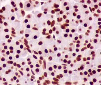 Immunohistochemistry (Formalin/PFA-fixed paraffin-embedded sections) - Anti-FUBP1/FBP antibody [EPR12327] (AB181111)