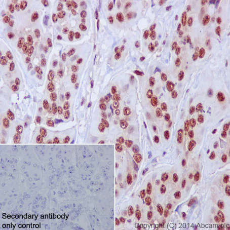 Immunohistochemistry (Formalin/PFA-fixed paraffin-embedded sections) - Anti-FUBP1/FBP antibody [EPR12327] - BSA and Azide free (AB240239)