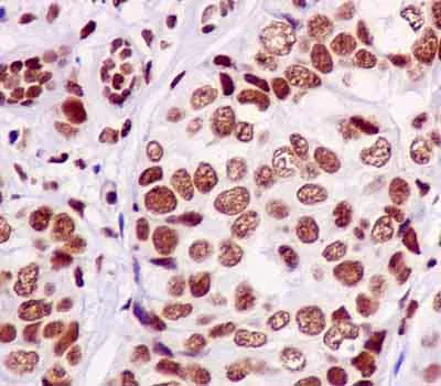 Immunohistochemistry (Formalin/PFA-fixed paraffin-embedded sections) - Anti-FUBP1/FBP antibody [EPR12327] - BSA and Azide free (AB240239)