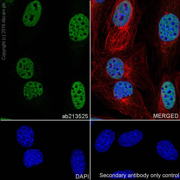 Immunocytochemistry/ Immunofluorescence - Anti-FUBP1/FBP antibody [EPR19208] (AB213525)