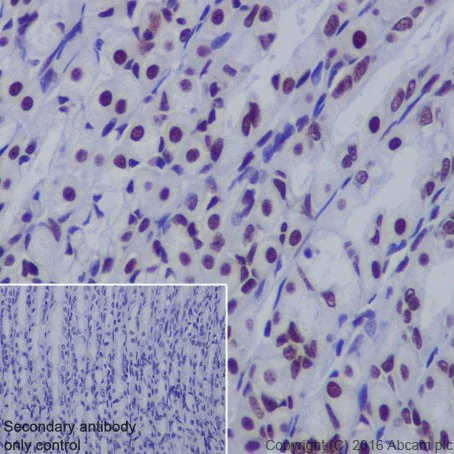 Immunohistochemistry (Formalin/PFA-fixed paraffin-embedded sections) - Anti-FUBP1/FBP antibody [EPR19208] (AB213525)
