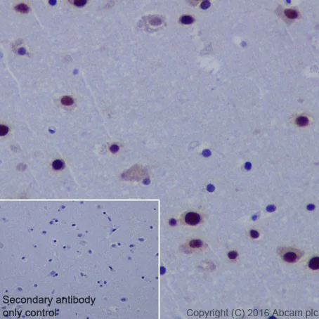 Immunohistochemistry (Formalin/PFA-fixed paraffin-embedded sections) - Anti-FUBP1/FBP antibody [EPR19208] (AB213525)
