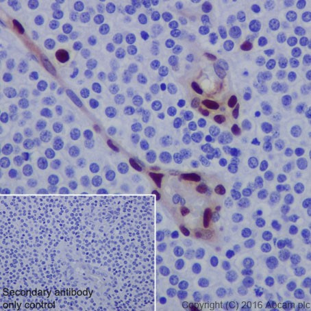 Immunohistochemistry (Formalin/PFA-fixed paraffin-embedded sections) - Anti-FUBP1/FBP antibody [EPR19208] (AB213525)
