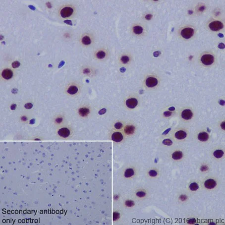 Immunohistochemistry (Formalin/PFA-fixed paraffin-embedded sections) - Anti-FUBP1/FBP antibody [EPR19208] (AB213525)