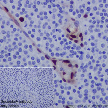 Immunohistochemistry (Formalin/PFA-fixed paraffin-embedded sections) - Anti-FUBP1/FBP antibody [EPR19208] - BSA and Azide free (AB251543)