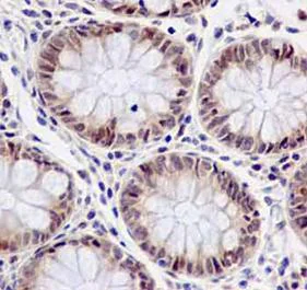 Immunohistochemistry (Formalin/PFA-fixed paraffin-embedded sections) - Anti-FUBP3 antibody [EPR13174-61] (AB181122)