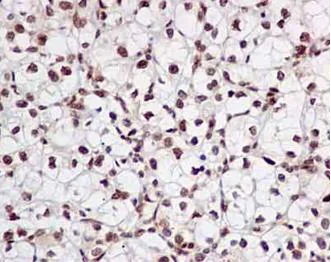 Immunohistochemistry (Formalin/PFA-fixed paraffin-embedded sections) - Anti-FUBP3 antibody [EPR13174-61] - BSA and Azide free (AB250363)