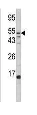 Western blot - Anti-FUCA1 antibody (AB230324)