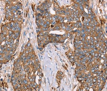 Immunohistochemistry (Formalin/PFA-fixed paraffin-embedded sections) - Anti-FUCA1 antibody - C-terminal (AB197984)